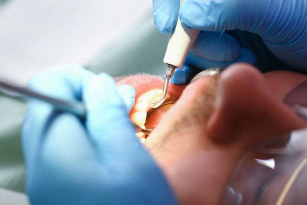 Best Urgent Care for Lost Fillings or Crowns in Osage, IA
